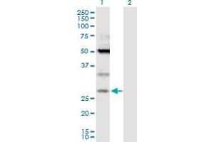 Western Blot analysis of TPD52 expression in transfected 293T cell line by TPD52 MaxPab polyclonal antibody. (TPD52 抗体  (AA 1-184))