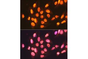 Immunofluorescence analysis of U-2 OS cells using ENT2/SLC29 Rabbit mAb (ABIN7270448) at dilution of 1:100 (40x lens). (SLC29A2 抗体)