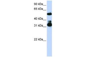 WB Suggested Anti-FBXW2  Antibody Titration: 0. (FBXW2 抗体  (Middle Region))