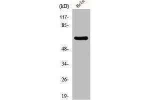 Western Blot analysis of HeLa cells using EAAT1 Polyclonal Antibody (SLC1A3 抗体  (C-Term))
