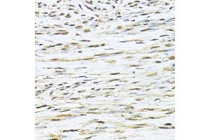 Immunohistochemistry of paraffin-embedded human uterus using Ku70 antibody (ABIN6134460, ABIN6150312, ABIN6150313 and ABIN6223171) at dilution of 1:100 (40x lens).