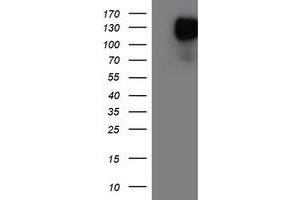 HEK293T cells were transfected with the pCMV6-ENTRY control (Left lane) or pCMV6-ENTRY ENPEP (Right lane) cDNA for 48 hrs and lysed. (ENPEP 抗体)