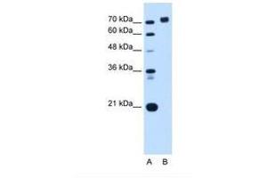 Image no. 1 for anti-Protein Tyrosine Phosphatase, Receptor Type, N (PTPRN) (AA 32-81) antibody (ABIN6738163) (PTPRN 抗体  (AA 32-81))