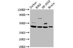 Western Blot Positive WB detected in: Jurkat whole cell lysate, K562 whole cell lysate, SH-SY5Y whole cell lysate, Rat brain tissue All lanes: HOXD3 antibody at 8.