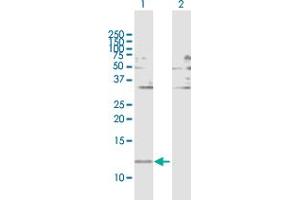 Western Blot analysis of FABP1 expression in transfected 293T cell line by FABP1 MaxPab polyclonal antibody. (FABP1 抗体  (AA 1-127))