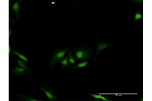 Immunofluorescence of purified MaxPab antibody to ORC6L on HeLa cell. (ORC6 抗体  (AA 1-252))