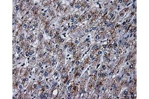 Immunohistochemical staining of paraffin-embedded pancreas tissue using anti-PLEKmouse monoclonal antibody. (Pleckstrin 抗体)