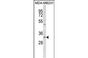 Western blot analysis in MDA-MB231 cell line lysates (35ug/lane). (FAHD2B 抗体  (C-Term))