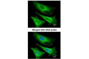 ICC/IF Image Immunofluorescence analysis of paraformaldehyde-fixed HeLa, using TNNI3K, antibody at 1:200 dilution. (TNNI3K 抗体)
