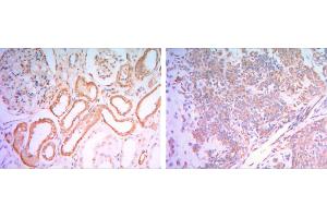 Immunohistochemical analysis of paraffin-embedded human salivary gland tissues (left) and kidney tissues (right) using HK1 mouse mAb with DAB staining. (Hexokinase 1 抗体)
