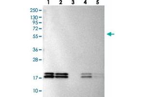 Western blot analysis of Lane 1: RT-4, Lane 2: U-251 MG, Lane 3: Human Plasma, Lane 4: Liver, Lane 5: Tonsil with NME1-NME2 polyclonal antibody  at 1:100-1:250 dilution. (NME1 抗体)