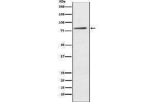 Western blot analysis of ELMO1 expression in Jurkat cell lysate.