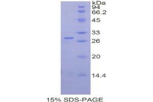 SDS-PAGE analysis of Human Renal Tumor Antigen Protein. (MOK 蛋白)