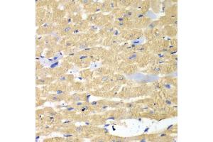 Immunohistochemistry of paraffin-embedded mouse heart using HAX1 antibody. (HAX1 抗体)
