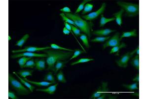 Immunofluorescence of purified MaxPab antibody to WTIP on HeLa cell. (WTIP 抗体  (AA 1-430))