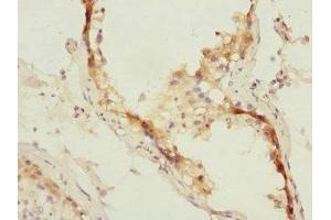 Immunohistochemistry of paraffin-embedded human testis tissue using ABIN7151071 at dilution of 1:100 (MID1 抗体  (AA 478-667))