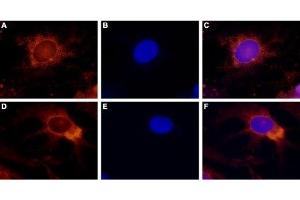Immunocytochemistry (ICC) image for anti-Transient Receptor Potential Cation Channel, Subfamily V, Member 4 (TRPV4) (AA 853-871), (Intracellular) antibody (ABIN7043850)