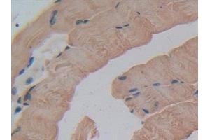 Immunohistochemistry (IHC) image for anti-Glutathione S-Transferase theta 1 (GSTT1) (AA 7-240) antibody (ABIN7432226)