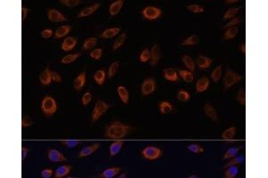 Immunofluorescence analysis of L929 cells using NTPCR Polyclonal Antibody at dilution of 1:100. (C1orf57 抗体)