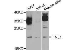 Western blot analysis of extract of various cells, using IFNL1 antibody. (IL29 抗体)