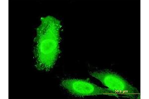 Immunofluorescence of monoclonal antibody to IRAK3 on HeLa cell. (IRAK3 抗体  (AA 497-596))