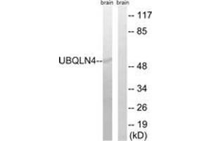 Western blot analysis of extracts from mouse brain cells, using UBQLN4 Antibody. (UBQLN4 抗体  (AA 201-250))