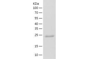 PTGES2 Protein (AA 1-206) (His tag)