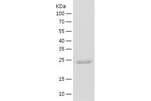 Western Blotting (WB) image for Prostaglandin E Synthase 2 (PTGES2) (AA 1-206) protein (His tag) (ABIN7124608)