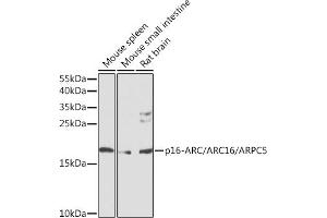 Western blot analysis of extracts of various cell lines, using p16-ARC//p16-ARC// antibody (ABIN6128967, ABIN6137131, ABIN6137132 and ABIN6224672) at 1:1000 dilution. (ARPC5 抗体  (AA 1-154))