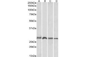 ABIN184675 (1µg/ml) staining of Mouse (A, C) and Rat (B, D) Brain (A, B) and Liver (C, D) lysates (35µg protein in RIPA buffer). (SIAH1 抗体  (N-Term))