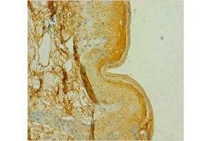 Immunohistochemistry of paraffin-embedded human skin tissue using ABIN7146852 at dilution of 1:100 (CSNK1A1 抗体  (Isoform alpha))