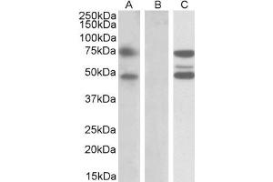 HEK293 lysate (10ug protein in RIPA buffer) overexpressing Human ASNSD1 with DYKDDDDK tag probed with ABIN5539631 (1ug/ml) in Lane A and probed with anti-DYKDDDDK Tag (1/10000) in lane C. (ASNSD1 抗体  (Internal Region))