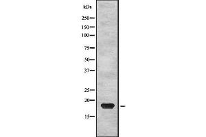 Western blot analysis of PTP4A2 using HepG2 whole cell lysates (PTP4A2 抗体  (Internal Region))