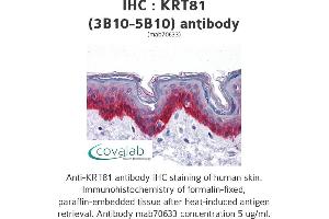 Image no. 1 for anti-Keratin 81 (KRT81) (AA 1-203), (full length) antibody (ABIN1723490) (KRT81 抗体  (full length))