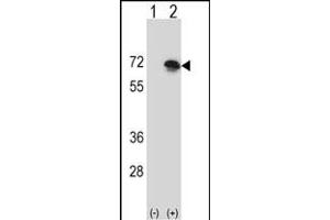 Western blot analysis of BLNK (arrow) using rabbit polyclonal BLNK Antibody (N-term) (ABIN657356 and ABIN2846406). (B-Cell Linker 抗体  (N-Term))