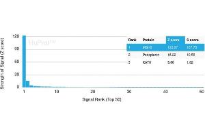 Analysis of Protein Array containing >19,000 full-length human proteins using MSH6 Mouse Monoclonal Antibody (MSH6/3091) Z- and S- Score: The Z-score represents the strength of a signal that a monoclonal antibody (MAb) (in combination with a fluorescently-tagged anti-IgG secondary antibody) produces when binding to a particular protein on the HuProtTM array. (MSH6 抗体  (AA 374-540))
