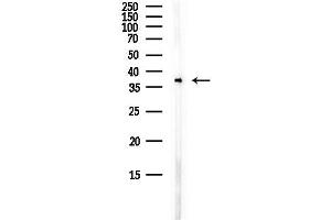 anti-Carbohydrate Kinase Domain Containing (Carkd) antibody