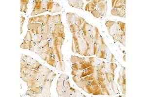 Immunohistochemistry of paraffin embedded rat skeletal muscle using Sarcomeric α Actinin (ABIN7075510) at dilution of 1:1000 (200x lens) (Sarcomeric alpha Actinin 抗体)