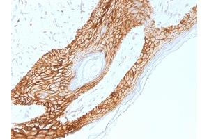 Formalin-fixed, paraffin-embedded human Skin stained with E-Cadherin Mouse Monoclonal Antibody (4A2).