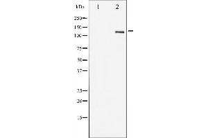 Western blot analysis of HER2 expression in 293 whole cell lysates,The lane on the left is treated with the antigen-specific peptide. (ErbB2/Her2 抗体  (C-Term))