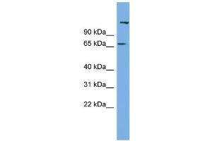 WB Suggested Anti-C12orf4 Antibody Titration: 0. (C12orf4 抗体  (N-Term))