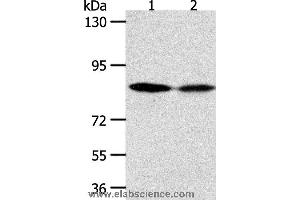 Western blot analysis of Hela and SKOV3 cell, using ADAM11 Polyclonal Antibody at dilution of 1:500 (ADAM11 抗体)