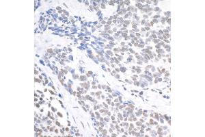 Immunohistochemistry (IHC) image for anti-Ubiquitin Specific Peptidase 7 (Herpes Virus-Associated) (USP7) (C-Term) antibody (ABIN7454512)