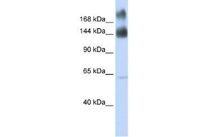 Kinectin 1 antibody used at 1 ug/ml to detect target protein. (KTN1 抗体)