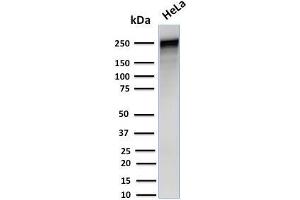 Western Blot Analysis of Human HeLa cell lysate using Spectrin alpha 1 Mouse Monoclonal Antibody (SPTA1/1832). (SPTA1 抗体  (AA 356-475))