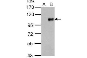 WB Image FOXM1 antibody detects FOXM1 protein by Western blot analysis. (FOXM1 抗体  (N-Term))