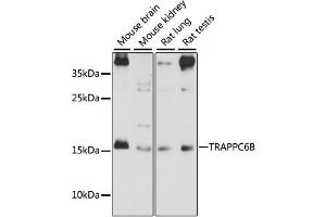 Western blot analysis of extracts of various cell lines, using TRAPPC6B antibody (ABIN6293632) at 1:1000 dilution. (TRAPPC6B 抗体)