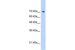 Western Blotting (WB) image for anti-Signal Transducer and Activator of Transcription 1, 91kDa (STAT1) antibody (ABIN2461817) (STAT1 抗体)