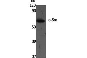 Western Blotting (WB) image for anti-Proto-oncogene tyrosine-protein kinase Src (Src) (Tyr419) antibody (ABIN5961533) (Src 抗体  (Tyr419))