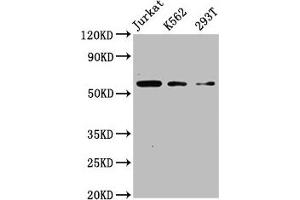 Western Blot Positive WB detected in: Jurkat whole cell lysate, K562 whole cell lysate, 293T whole cell lysate All lanes: CFLAR antibody at 4 μg/mL Secondary Goat polyclonal to rabbit IgG at 1/50000 dilution Predicted band size: 56, 26, 42, 28, 52, 51, 40, 31, 35, 53, 34, 24, 50, 45 kDa Observed band size: 56 kDa (FLIP 抗体  (AA 1-250))